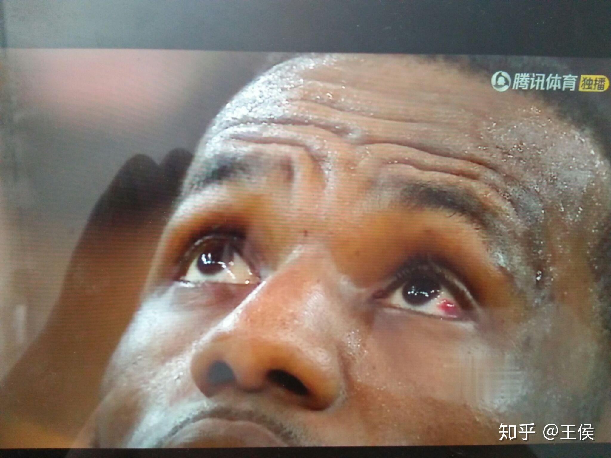 包含克里夫兰骑士完成体检备战NBA常规赛TheShy遭遇十连败之后，加时末段深圳男篮手感冰凉的词条